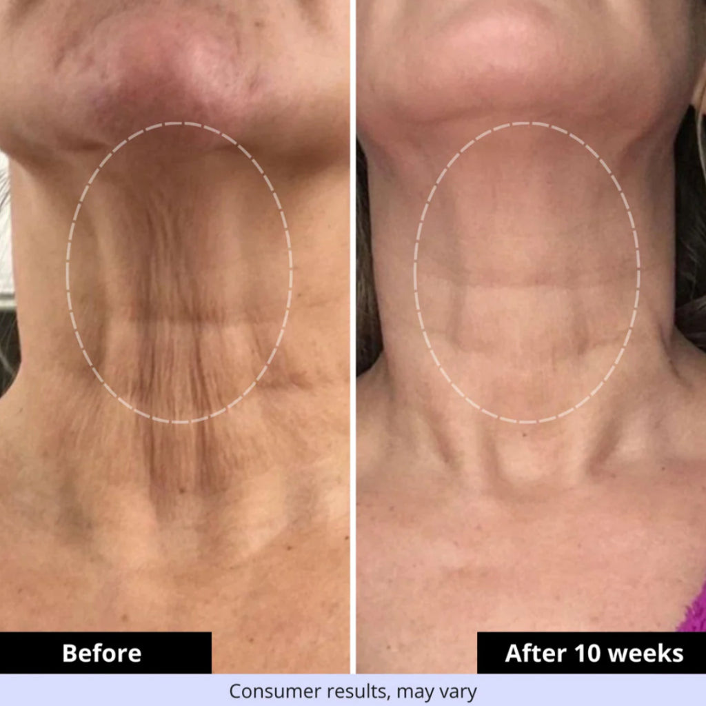 Tighten & Lift Neck Cream